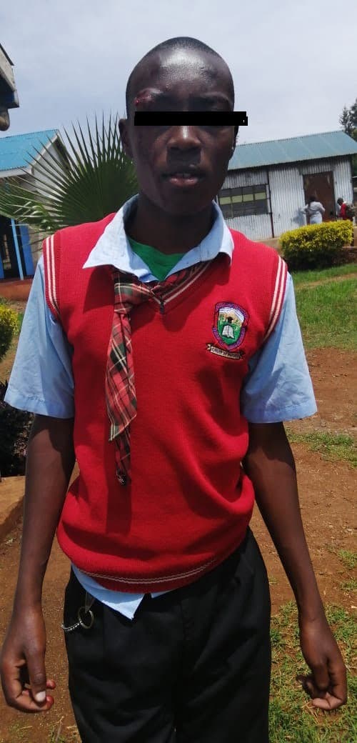 Police attack, injure Kajiado student for making noise in school