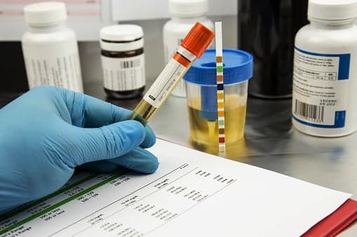 Mandatory drug testing in schools is a simplistic way of addressing a huge problem