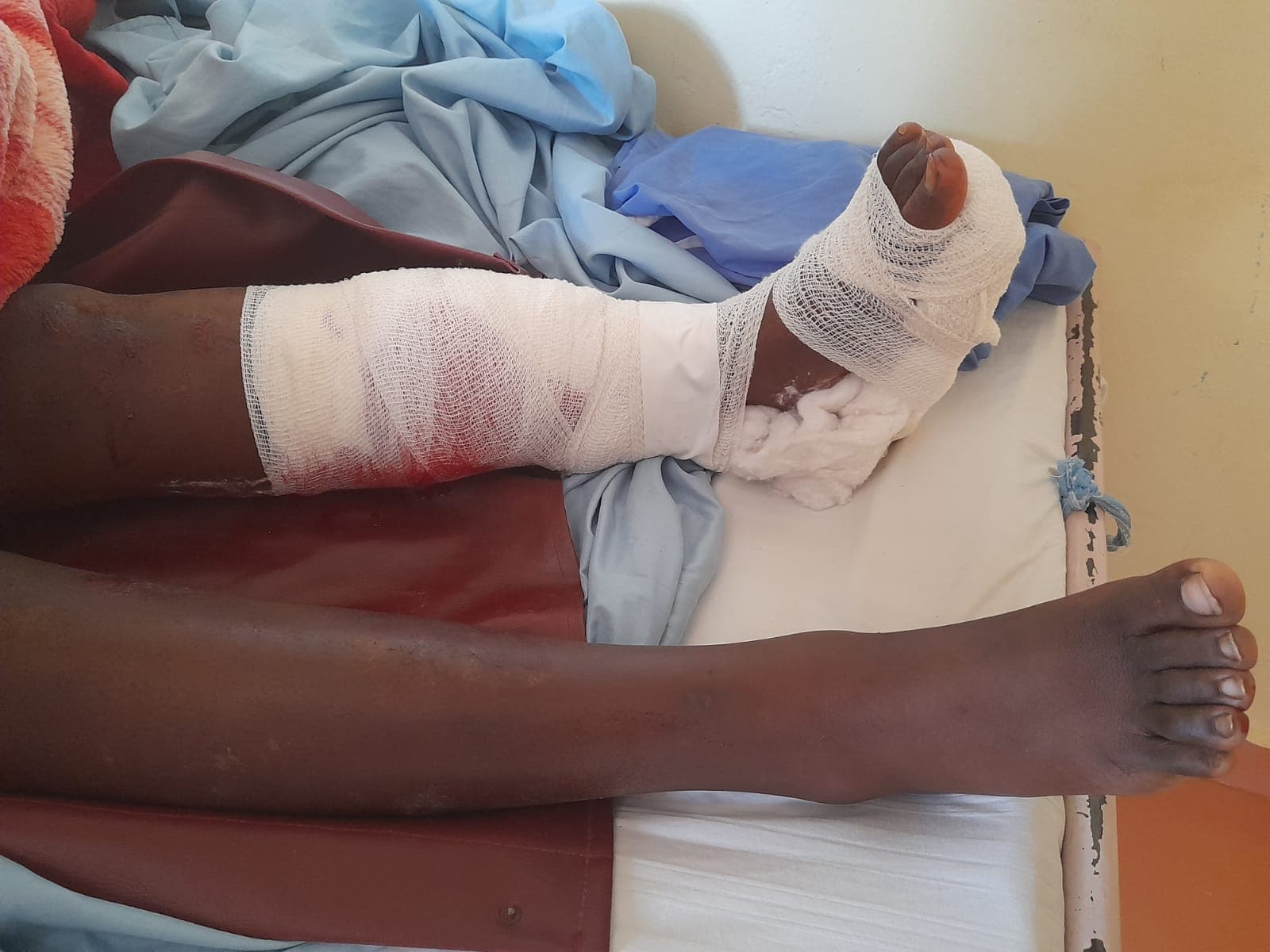 Three students recuperating after septic tank accident in Busia county