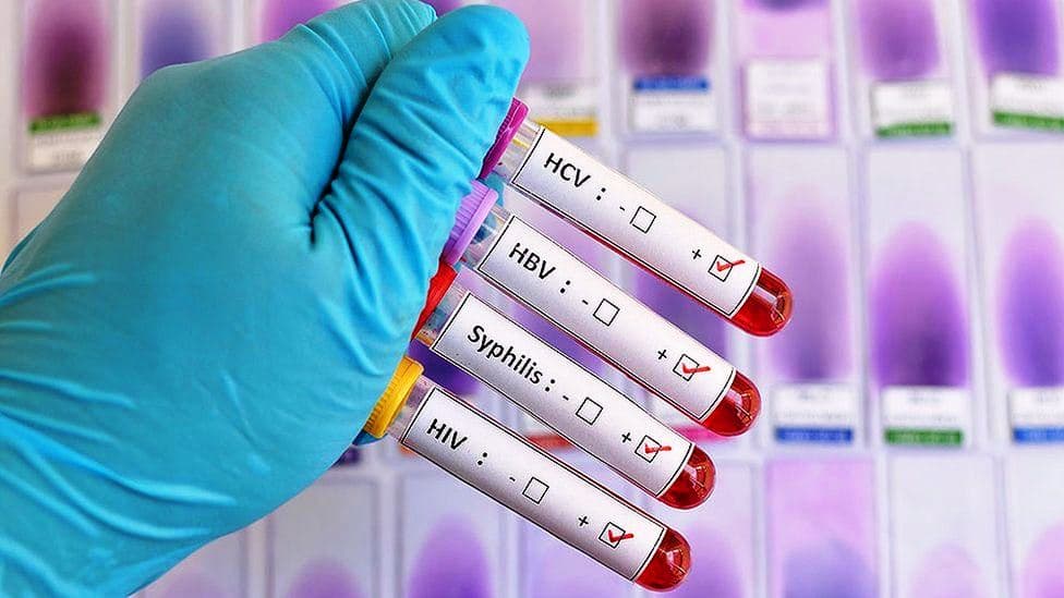 Shock as 75 per cent of Kirinyaga students test positive for STDs