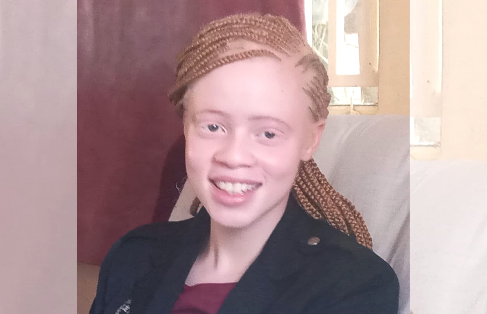Precious girl demystifies Albinism with top notch performance