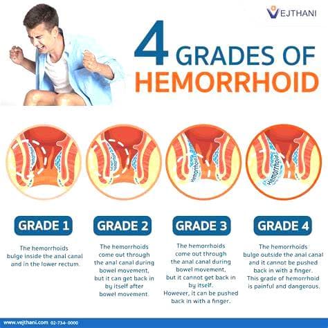 Reflections: Healed of hemorrhoids image 1