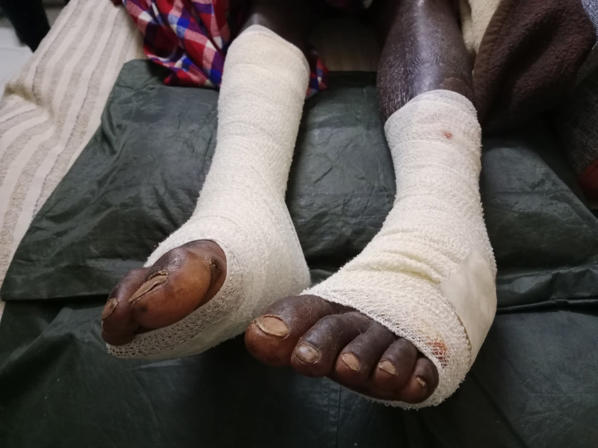 17-year-old student hospitalized after alleged police assault in Narok