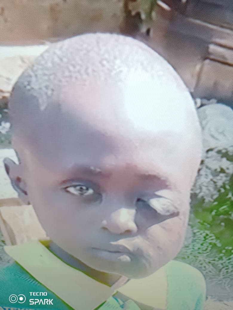Poor Nyamira family appeals for help to treat their ailing child
