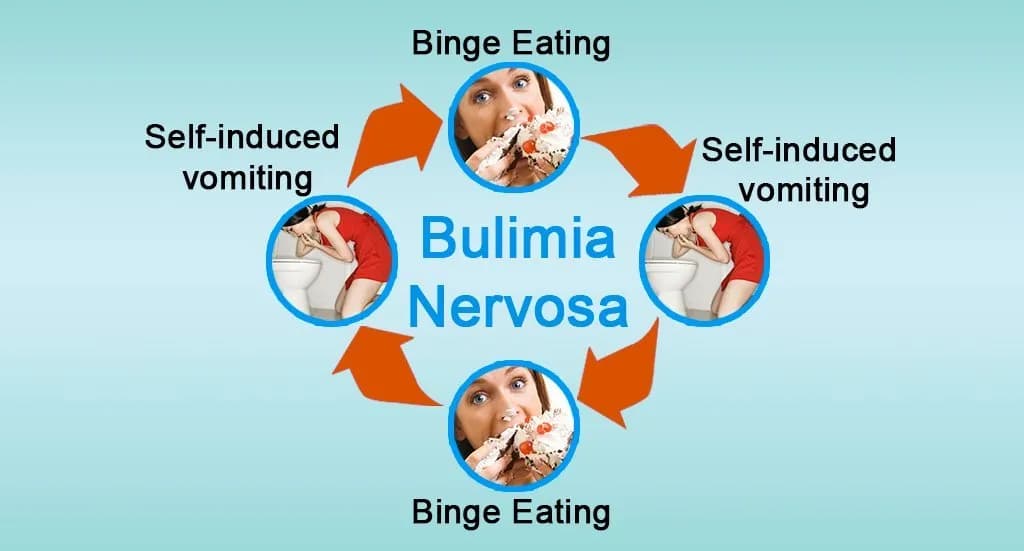 Understanding Bulimia Nervosa disorder and how it affects learning