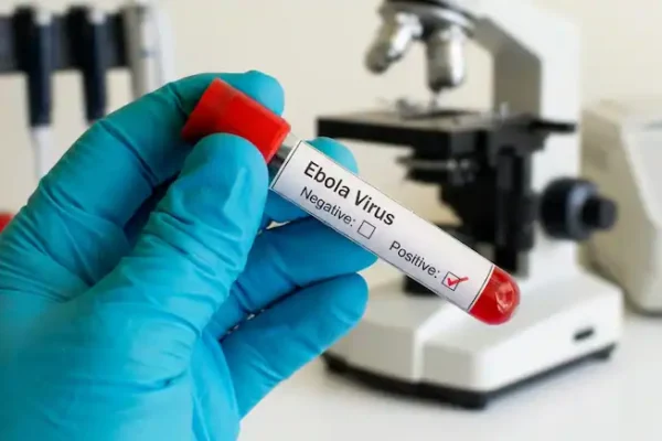Ebola